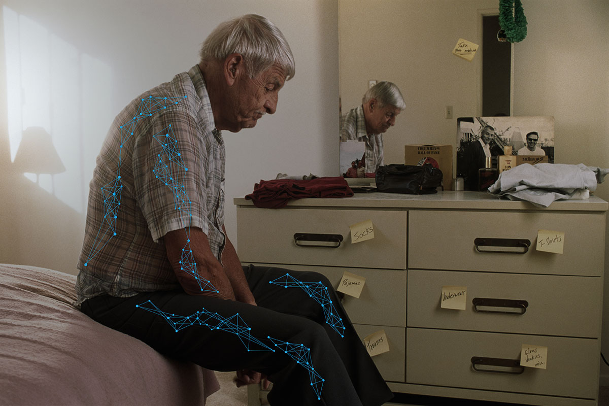 Alzheimer